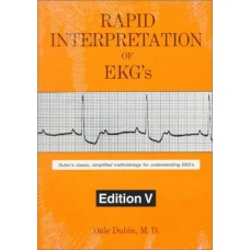RAPID ENTERPRETATION OF EKG'S