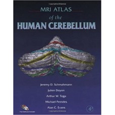 MRI ATLAS OF THE HUMAN CEREBELLUM